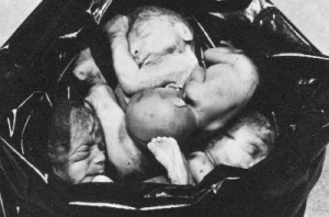 aborted babies